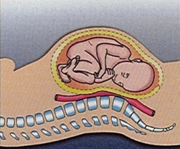 Modificaciones en los pies durante el embarazo